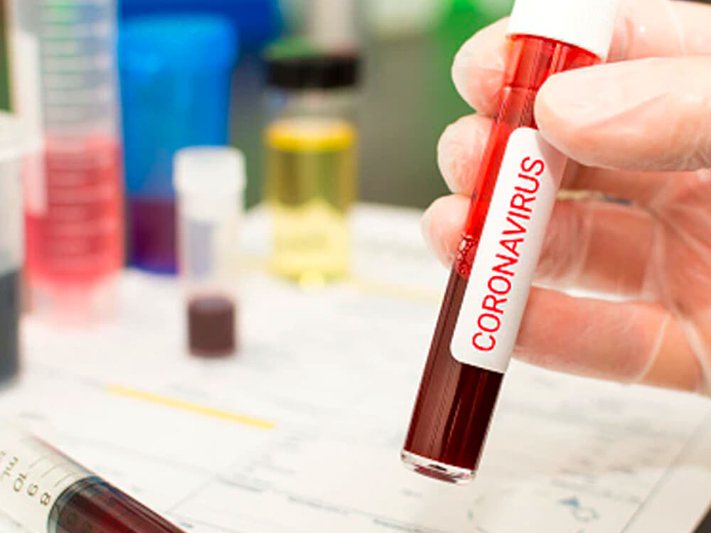 Coronavirus, and how it could impact your supply chain